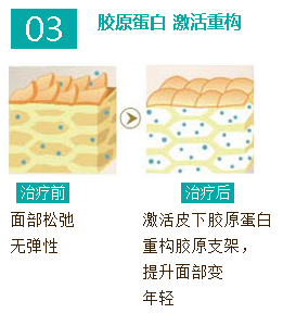 紧肤除皱